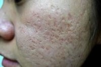 Boxcar Scars Boxcar Scars